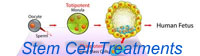 Stem Cell Treatments