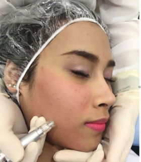 Miracle Smooth Skin Rejuvenation