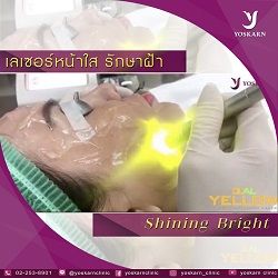 melasma treatment Thailand