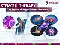 stem cell joint repair Thailand