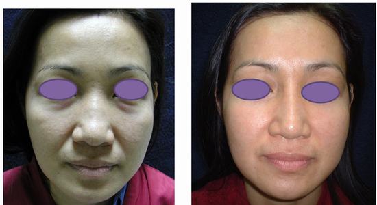 dermatology clinic Thailand